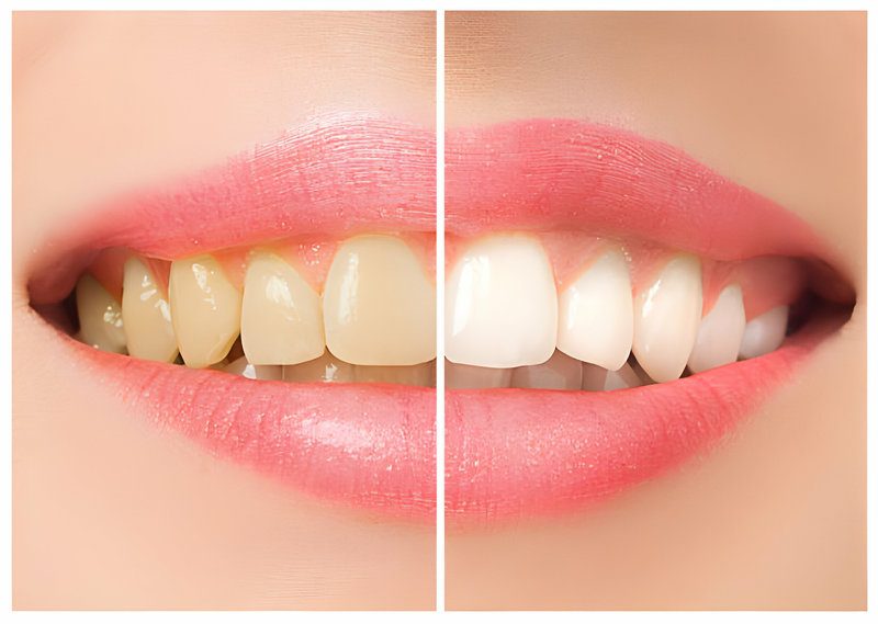A Comprehensive Guide to Finding the Right Cosmetic Dentist for You_FI