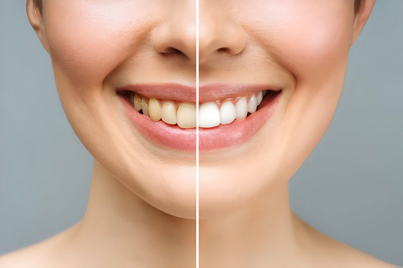 The Ultimate Guide to Finding the Right Cosmetic Dentist_FI