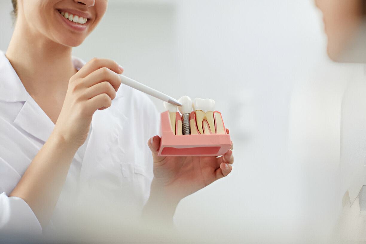 Dental Implants vs. Other Tooth Replacement Options – Expert Advice from Carolina Coast Family Dentistry in Shallotte, NC_FI