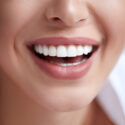 The Benefits of Combining Teeth Whitening and Veneers for a Flawless Smile in Shallotte, NC