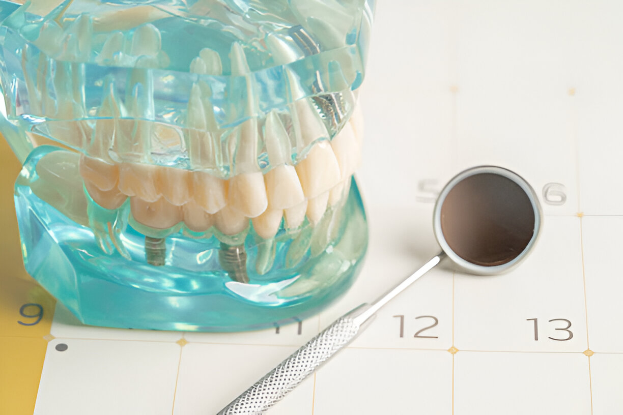 Maintaining Your Dentures for Long-Lasting Comfort in Shallotte, NC