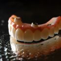 Carolina Coast Family Dentistry: Your Local Specialist for Implant-Supported Dentures in Shallotte_FI