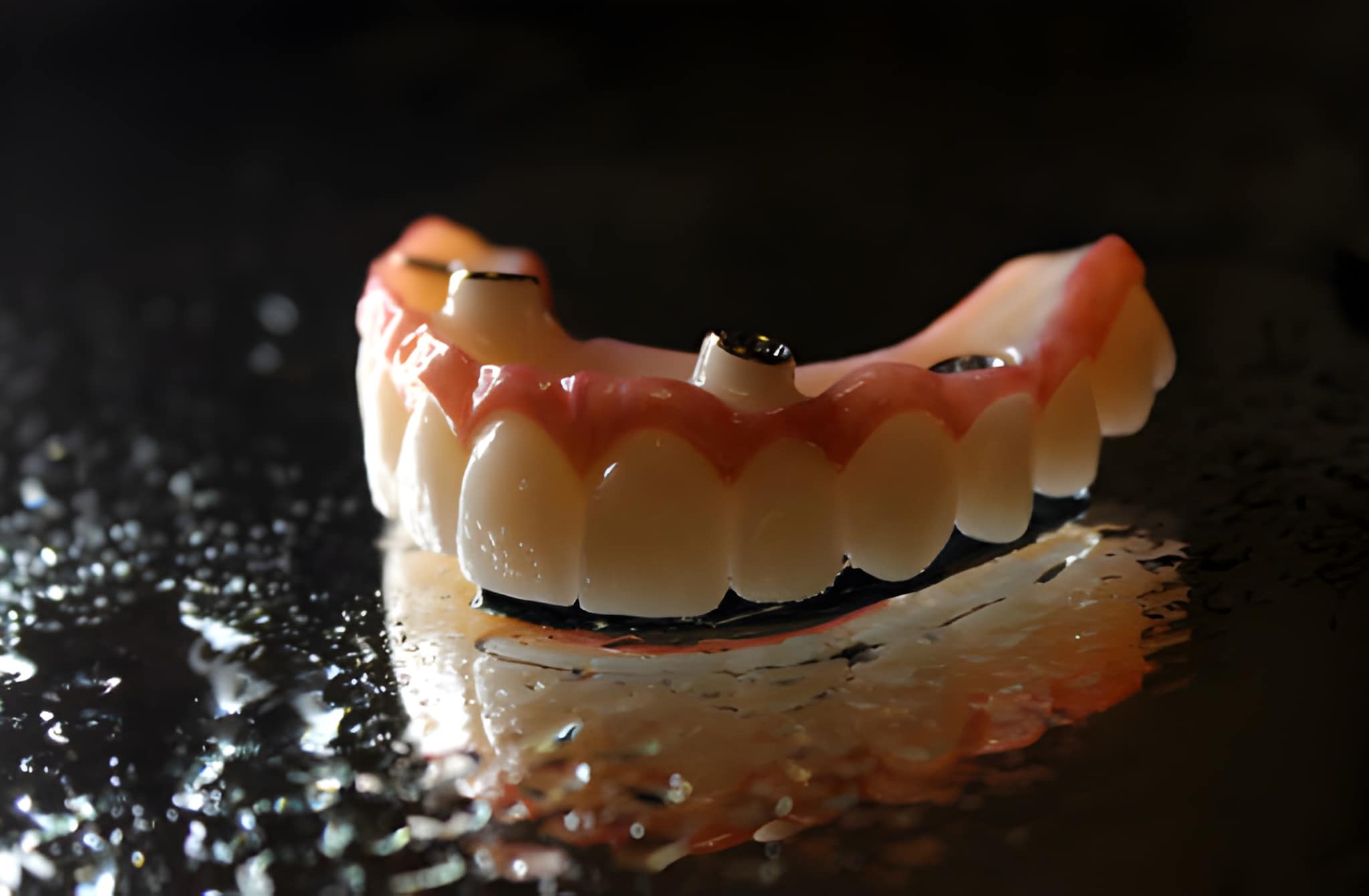 Carolina Coast Family Dentistry: Your Local Specialist for Implant-Supported Dentures in Shallotte_FI